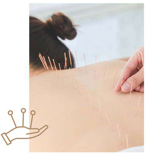 Acupuncture:RebalancingEnergyforEmotionalWell-being