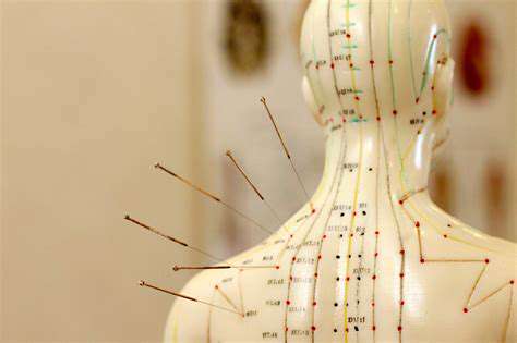 AcupunctureandotherTCMTechniquesforInsomniaRelief