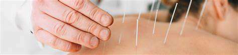 Acupuncture for Migraines: A Traditional Approach