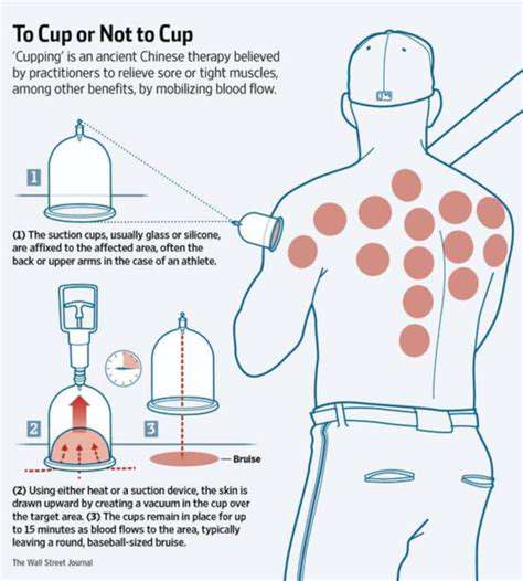 HowDoesCuppingWorkforMusclePain?